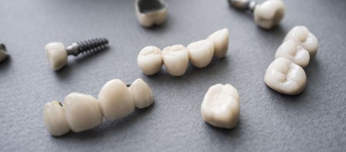 crowns and bridges lying on a table ready to be used to improve patients' smiles.