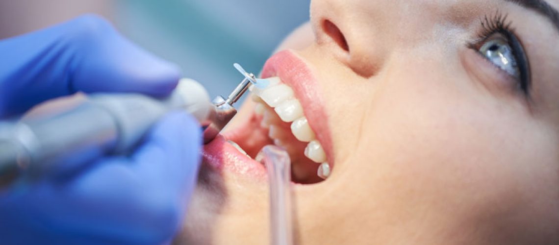 an up-close picture of a patient with her mouth open as a doctor gives her a professional tooth cleaning that will benefit her.